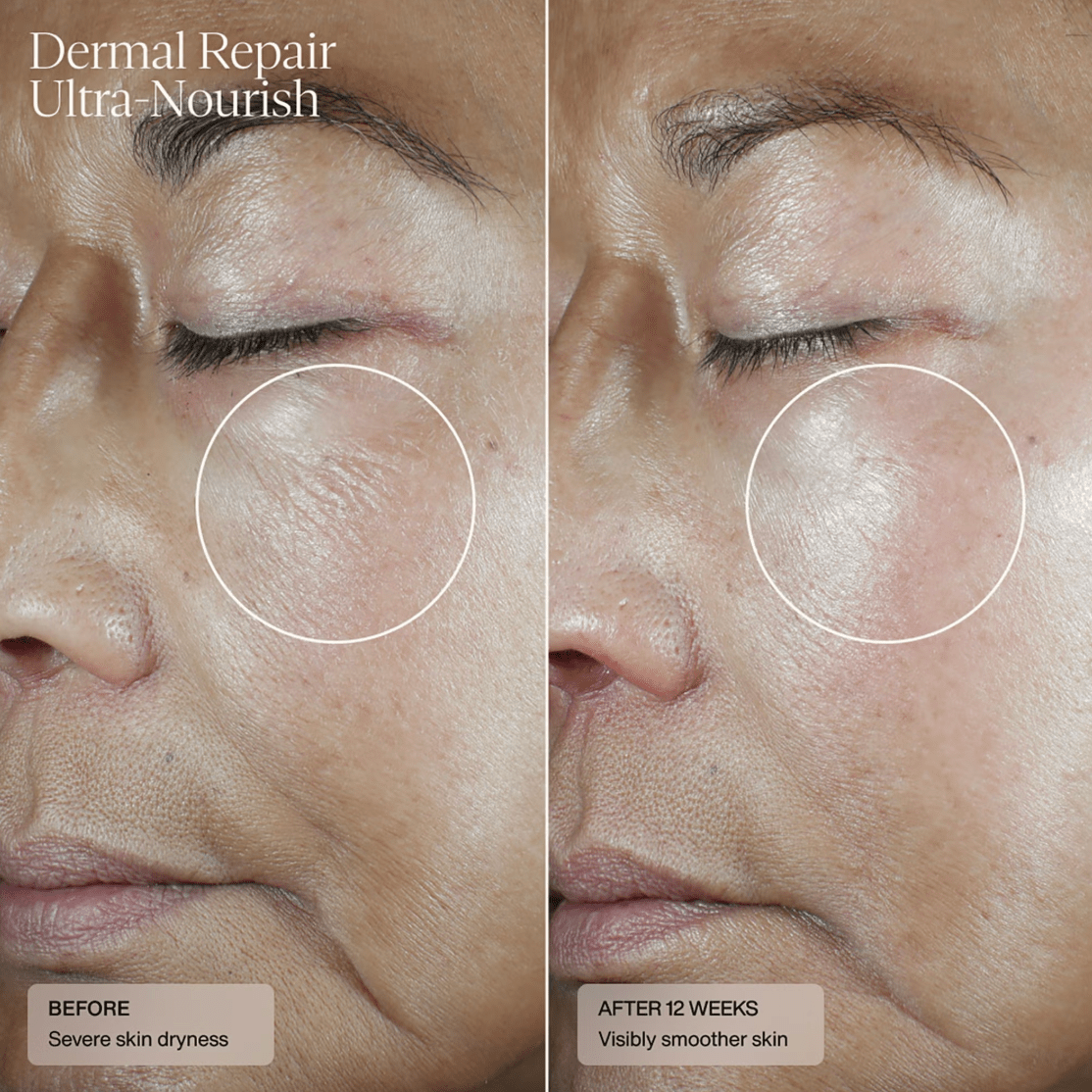 Senté Dermal Repair Ultra Nourish Moisturizer Senté