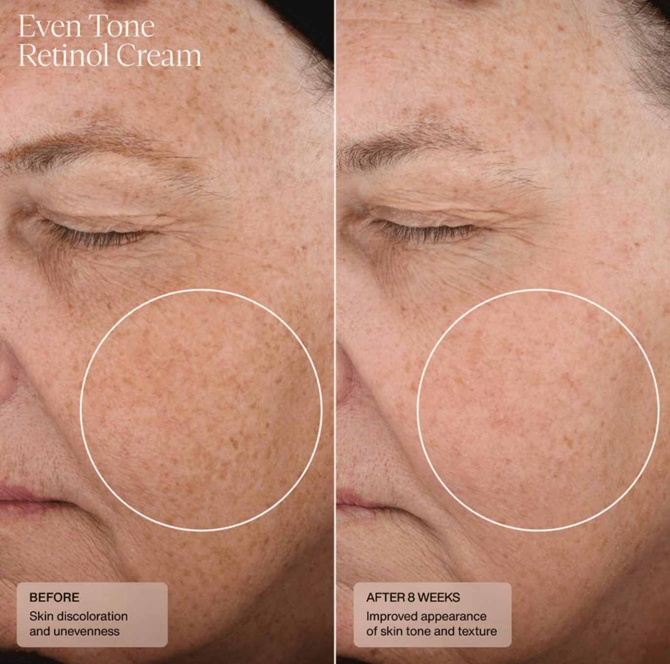 Senté Even Tone Retinol Cream Senté