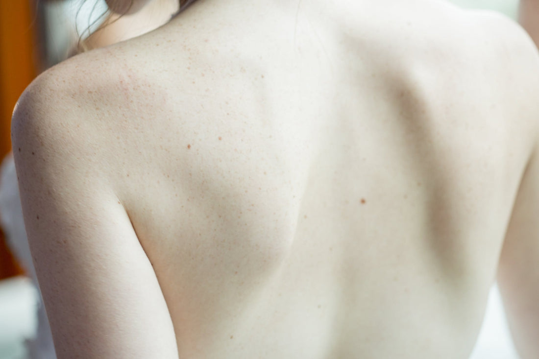 3 Reasons To Get A Back Facial
