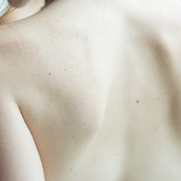 3 Reasons To Get A Back Facial