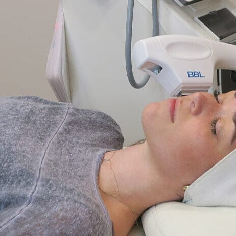 How to Help Treat Rosacea