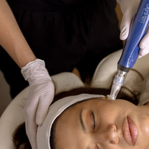 Hyperpigmentation vs. Melasma: Causes & Treatment Options