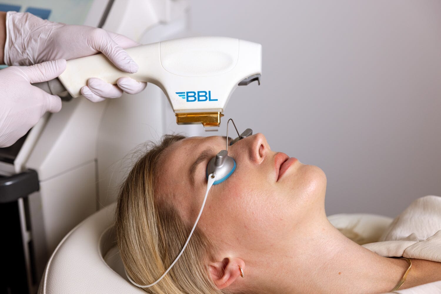laser season: why fall + winter are the best time for laser treatments