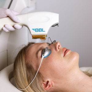 laser season: why fall + winter are the best time for laser treatments