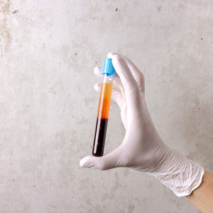 PRP for Hair Loss: What It Is, How It Works & What to Expect