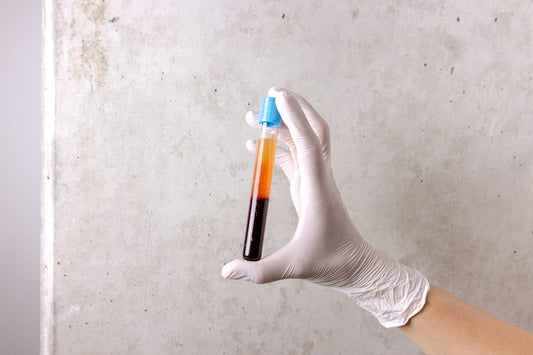 PRP for Hair Loss: What It Is, How It Works & What to Expect