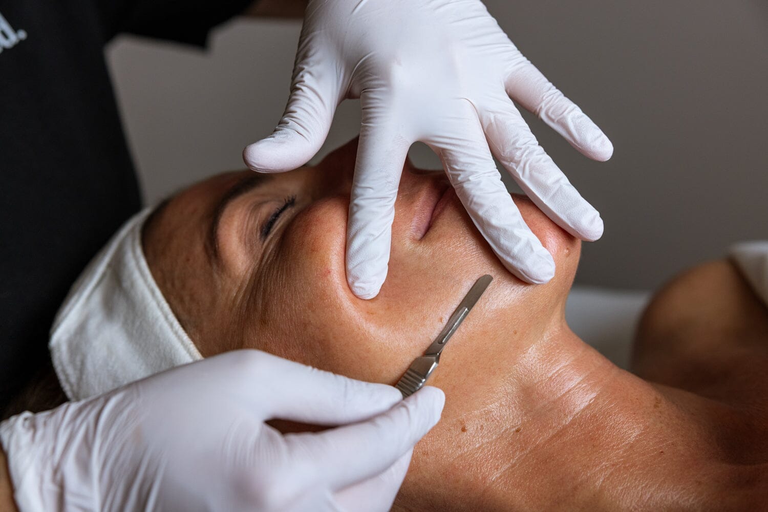 The down low on dermaplaning: smoother skin, zero downtime