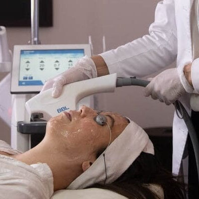 The Ultimate Guide to Laser Skin Resurfacing