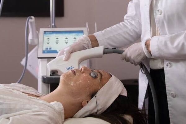 The Ultimate Guide to Laser Skin Resurfacing