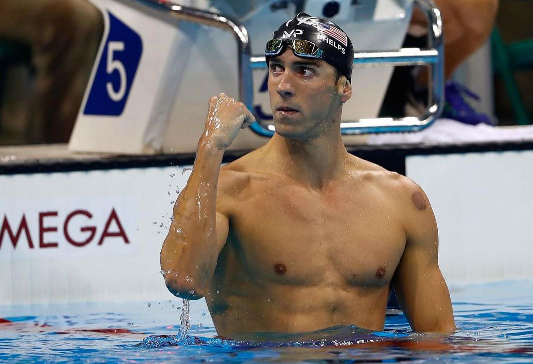 What Is Cupping?