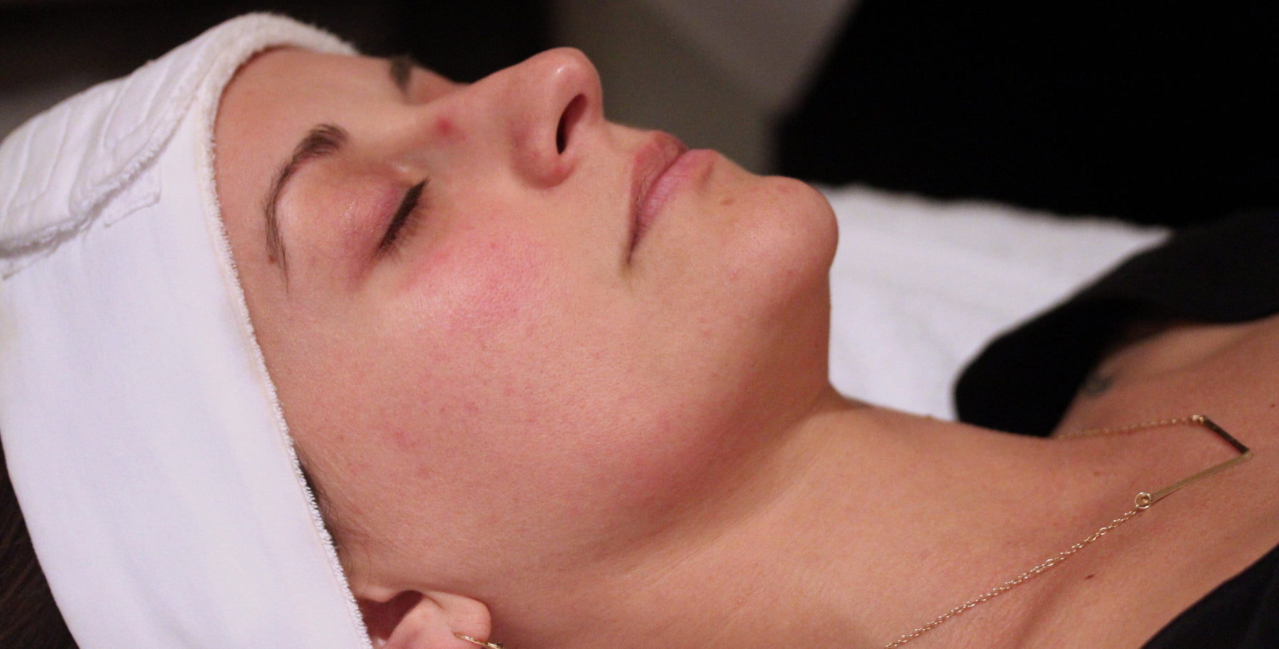 What Is the Perk Treatment?