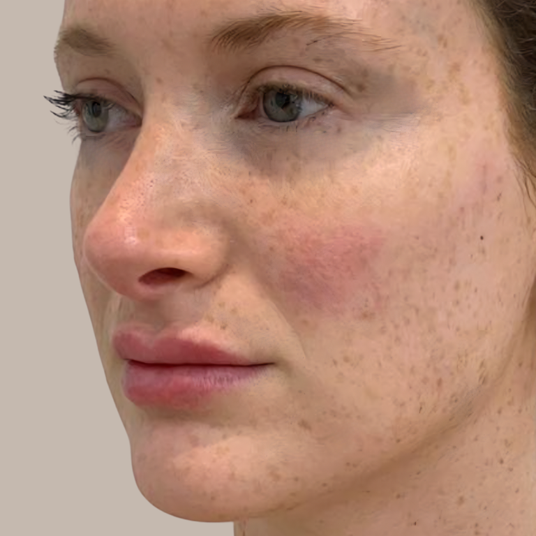 Close-up of a woman's face showing skin texture, freckles, and a pink blush on her cheek against a plain beige background.