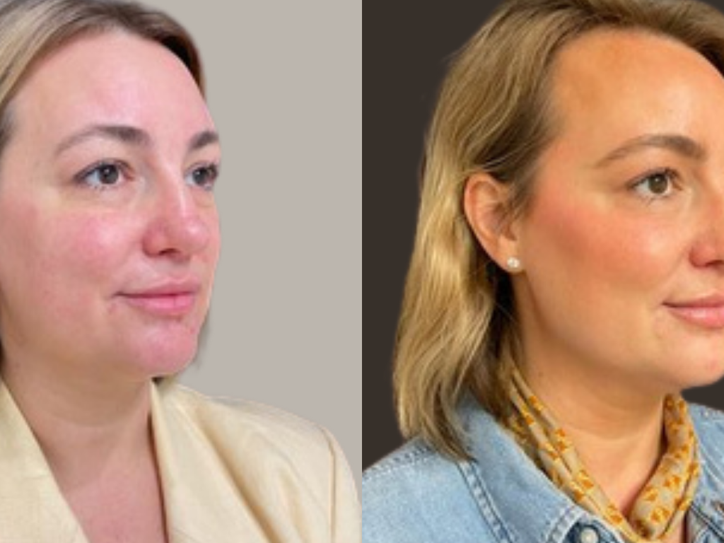 A side-by-side before and after style portrait of a woman with blonde hair, showing a skincare or makeup transformation against a neutral beige and dark brown background.