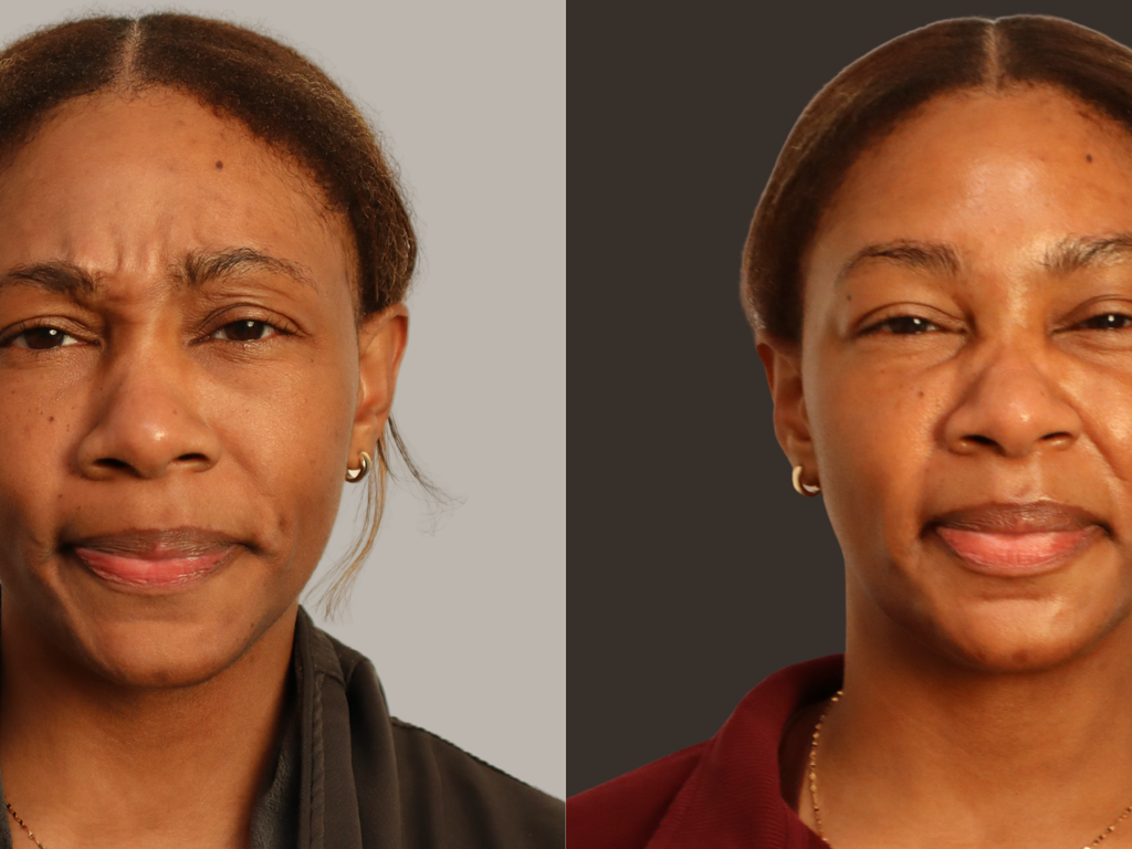 A side-by-side portrait comparison of the same woman, shown from the chest up against two neutral backgrounds. The left side has a light gray background and she is wearing a dark top; the right side has a dark gray background and she is wearing a burgundy top.