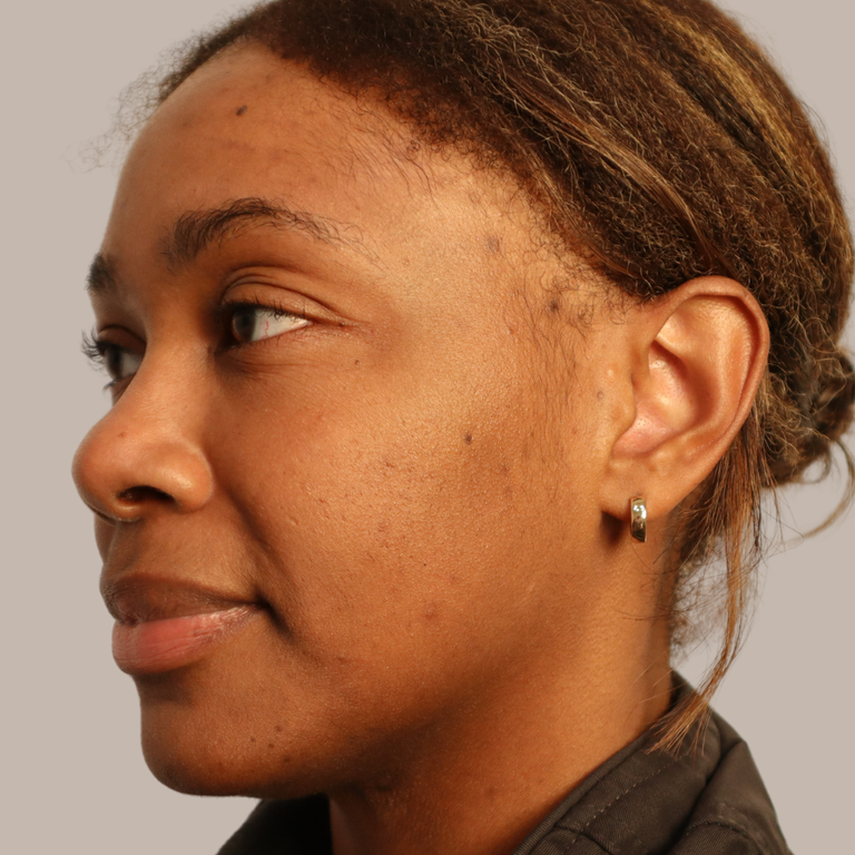 A close-up side profile of a woman wearing a small gold hoop earring, set against a plain light gray background.