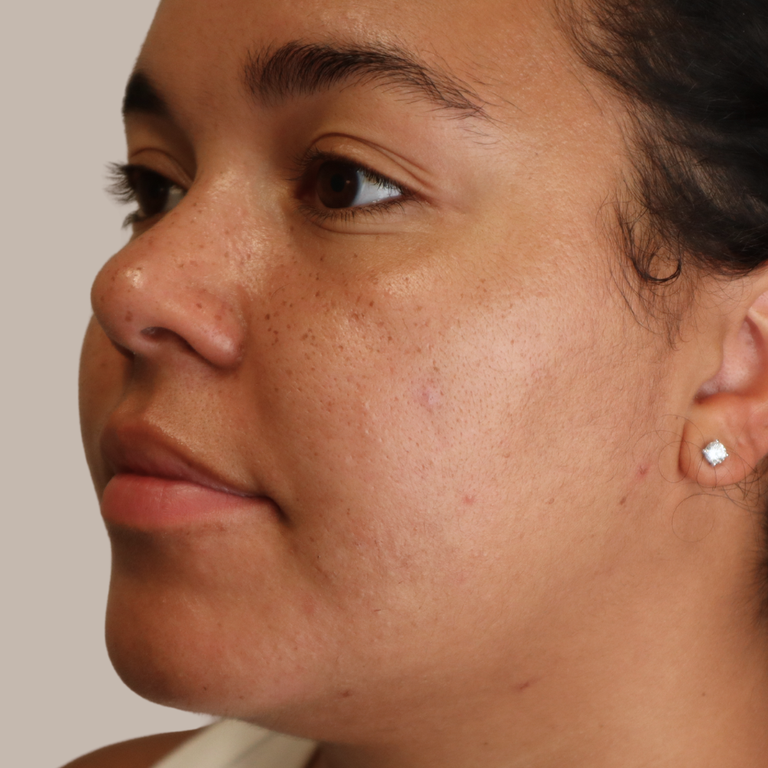 Close-up side profile of a woman wearing a small silver stud earring against a plain light beige background.