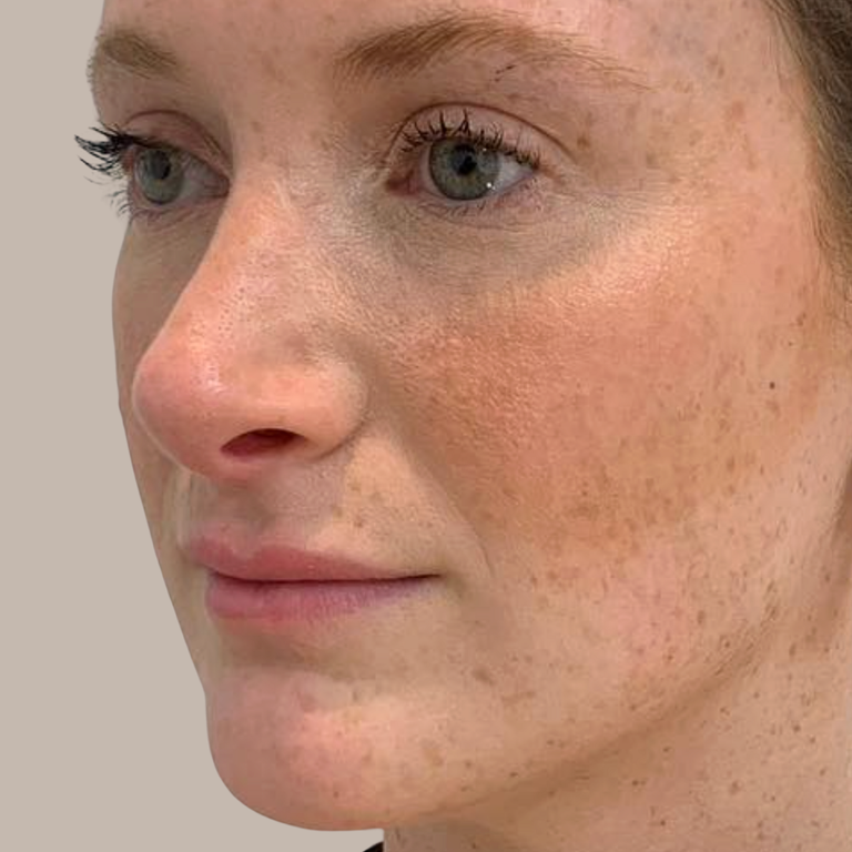 Close-up of a woman's face showing natural skin texture, freckles, and makeup applied to her cheeks and nose, against a plain light beige background.