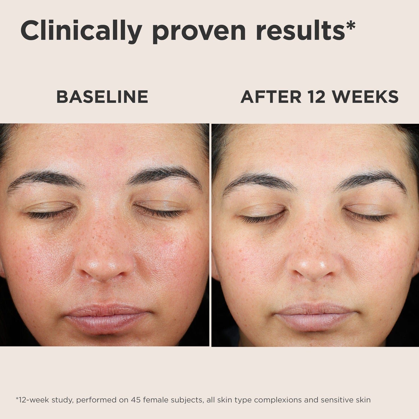 EltaMD UV Skin Recovery Green Tint SPF 50 milk + honey 