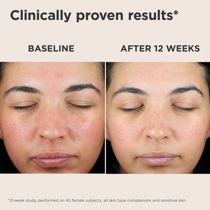 EltaMD UV Skin Recovery Green Tint SPF 50 milk + honey 