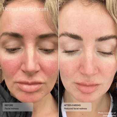 Senté Dermal Repair Cream Senté 