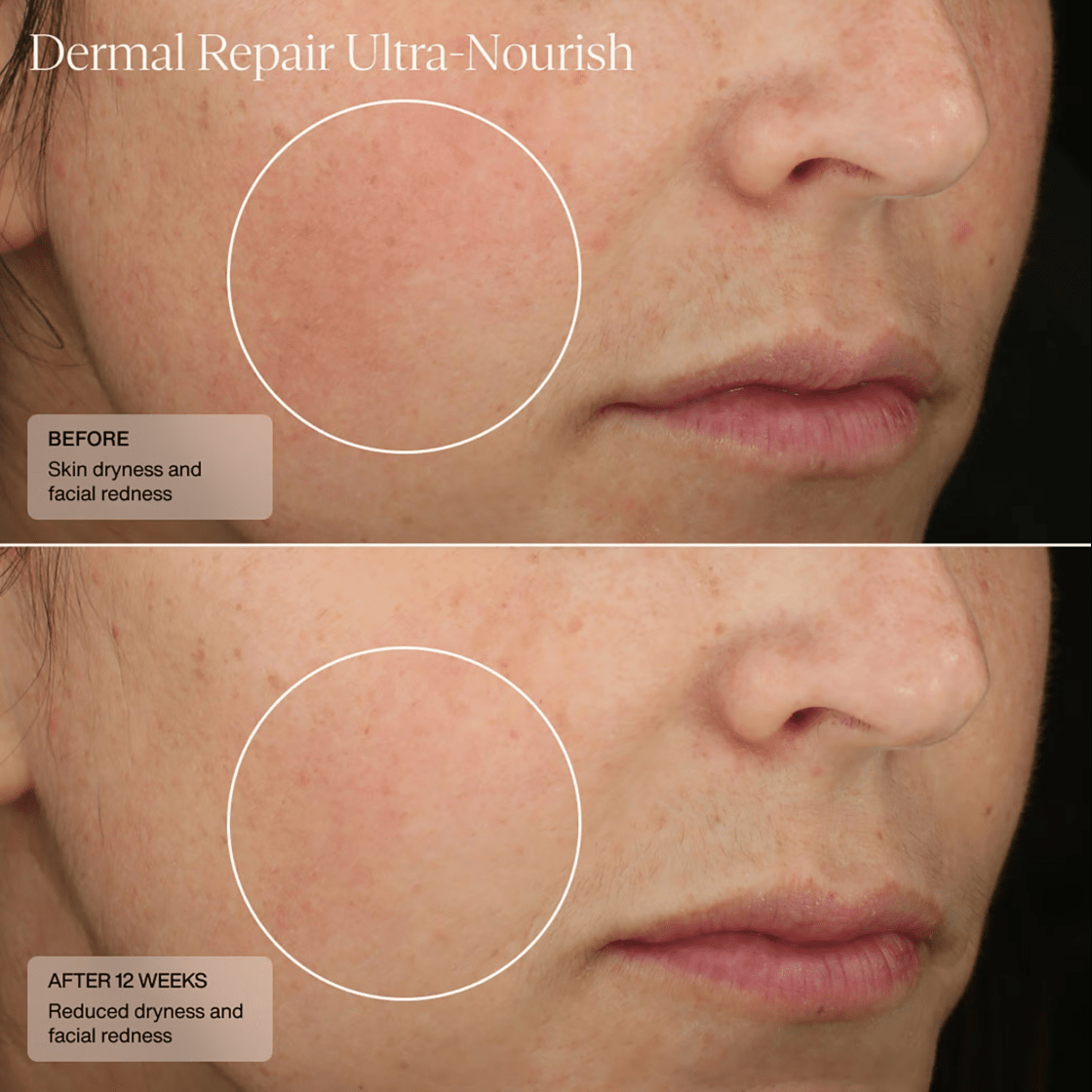 Senté Dermal Repair Ultra Nourish Moisturizer Senté 