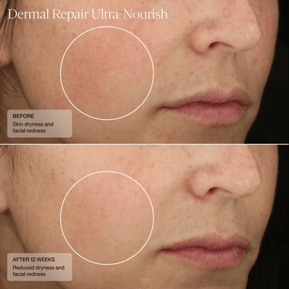 Senté Dermal Repair Ultra Nourish Moisturizer Senté 
