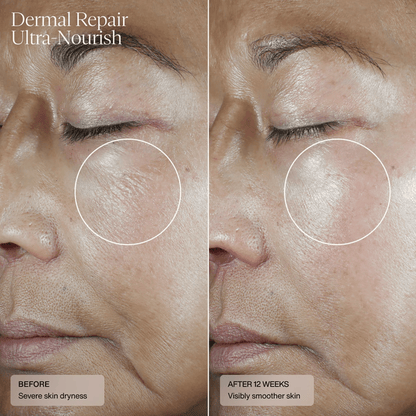 Senté Dermal Repair Ultra Nourish Moisturizer Senté 