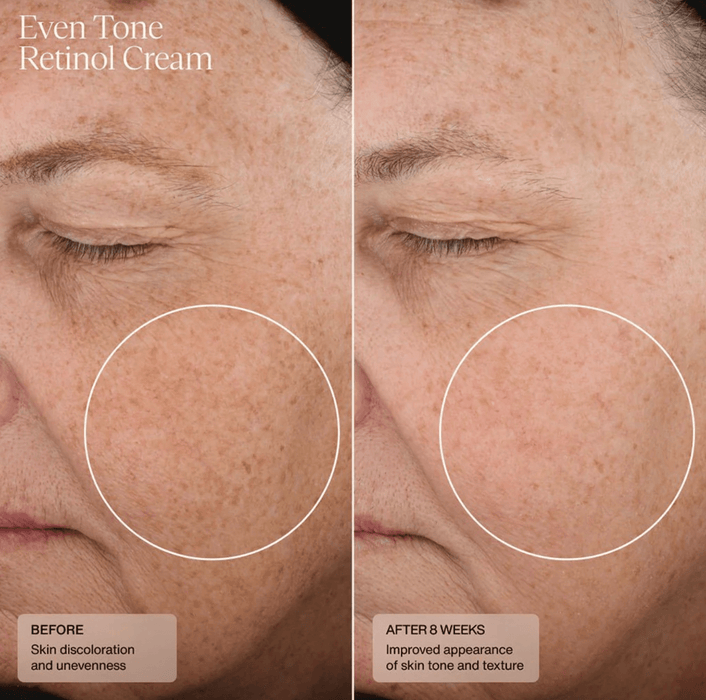 Senté Even Tone Retinol Cream Senté 