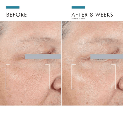 SkinCeuticals A.G.E. Advanced Eye Moisturizer Skinceuticals 