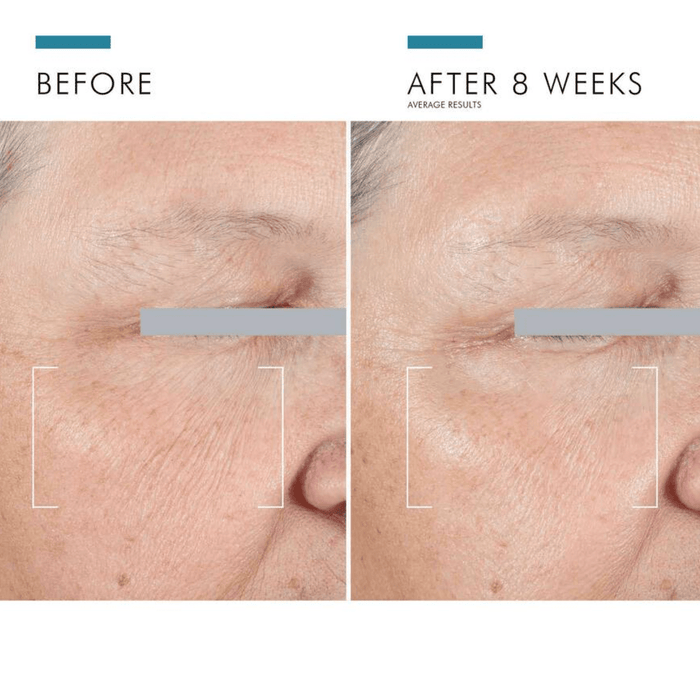 SkinCeuticals A.G.E. Advanced Eye Moisturizer Skinceuticals 